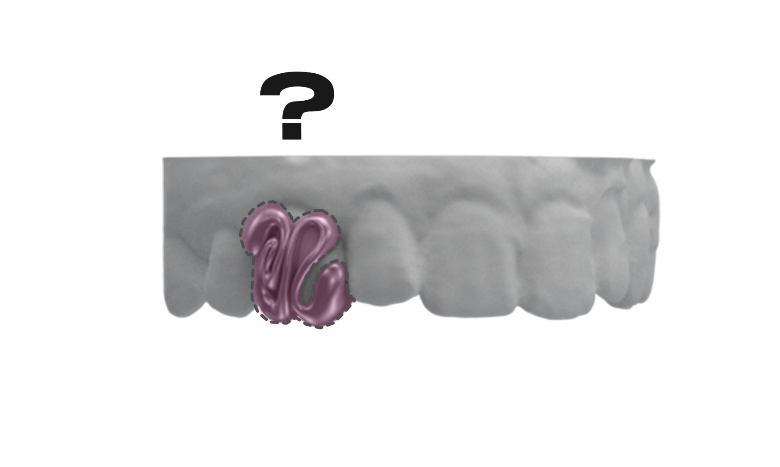 Custom Grillz