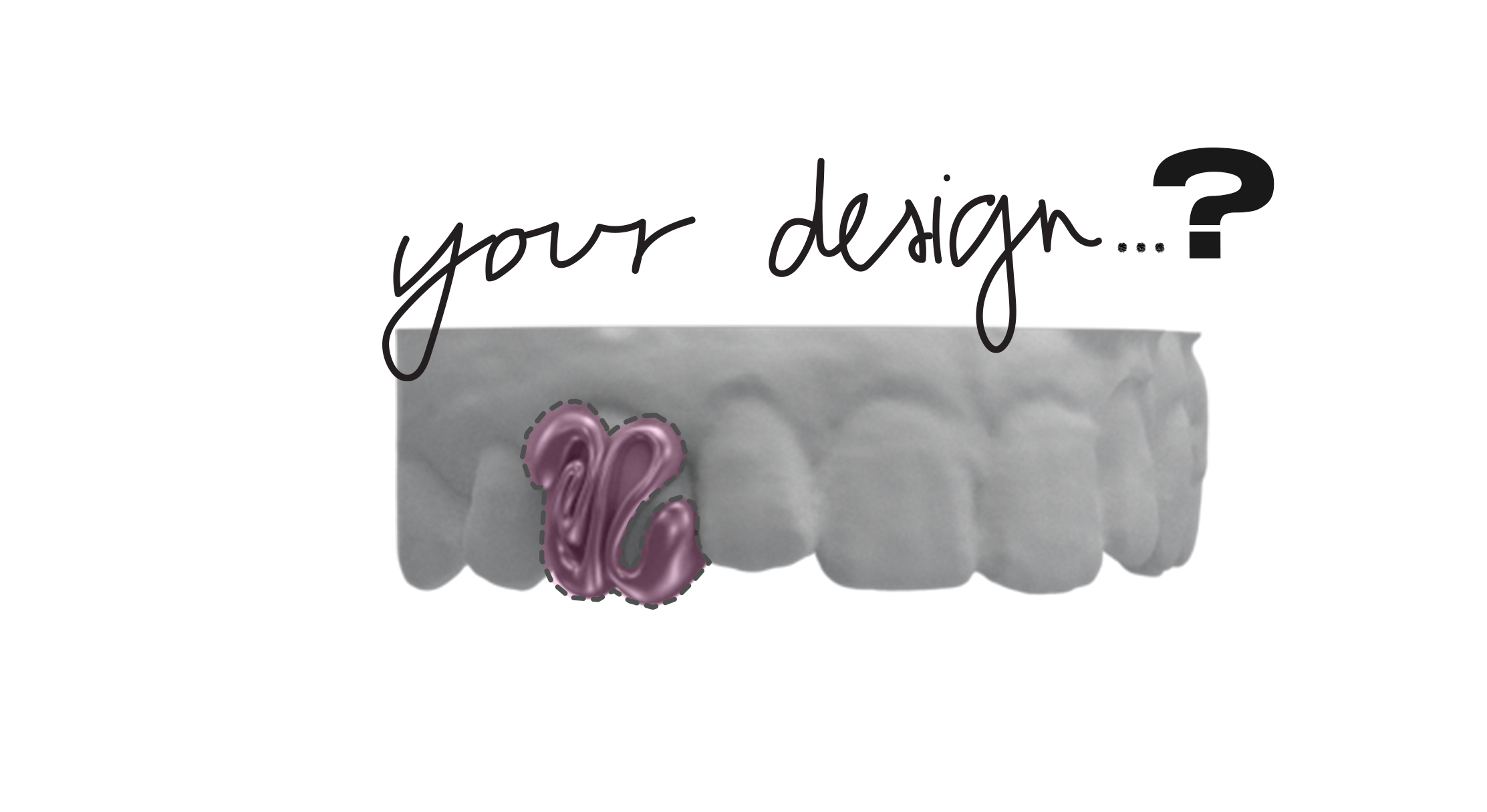 Custom Grillz