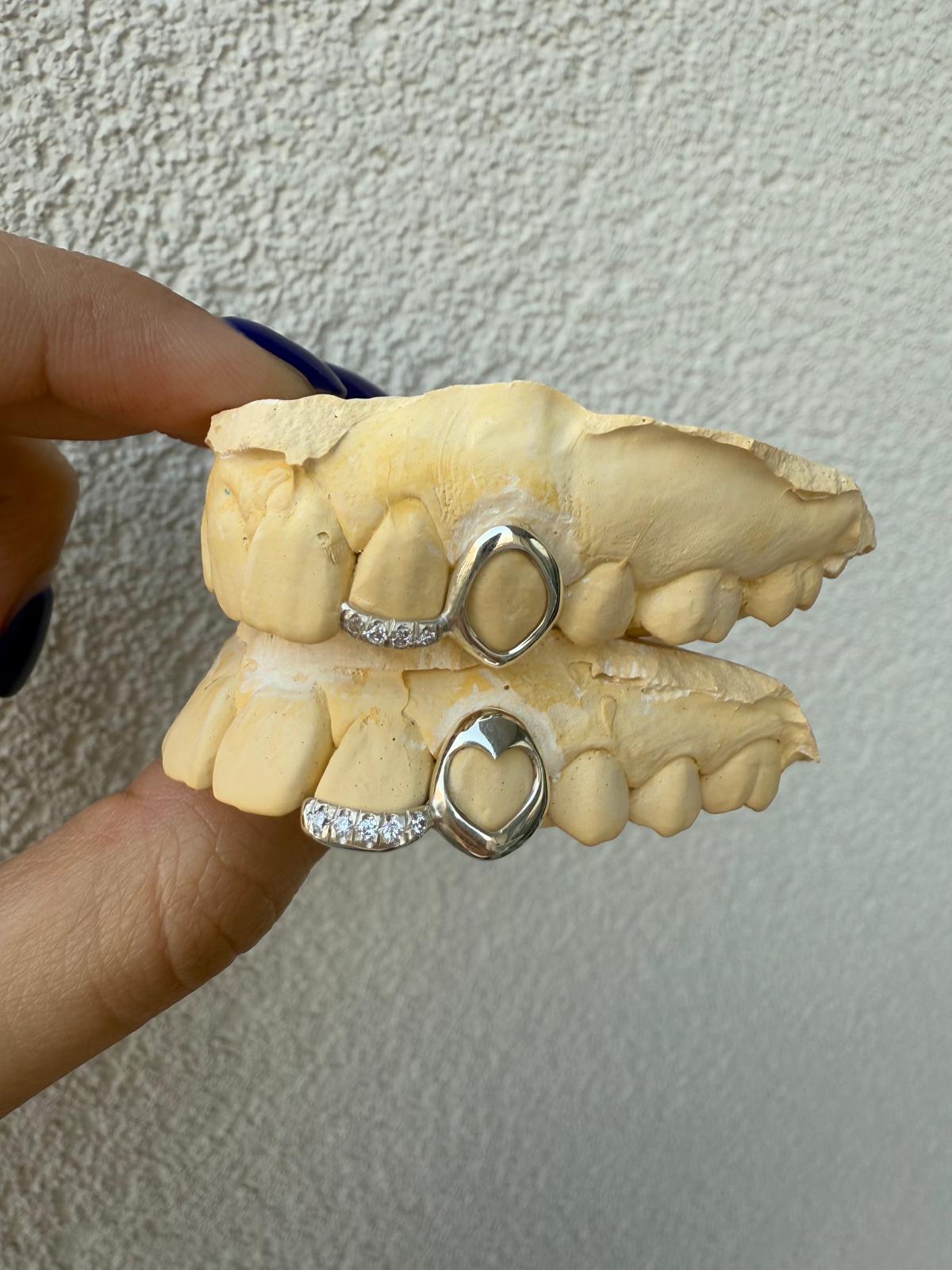 Window + Inlay + Grillz