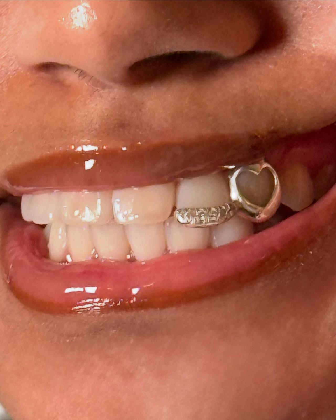 Window + Inlay + Grillz