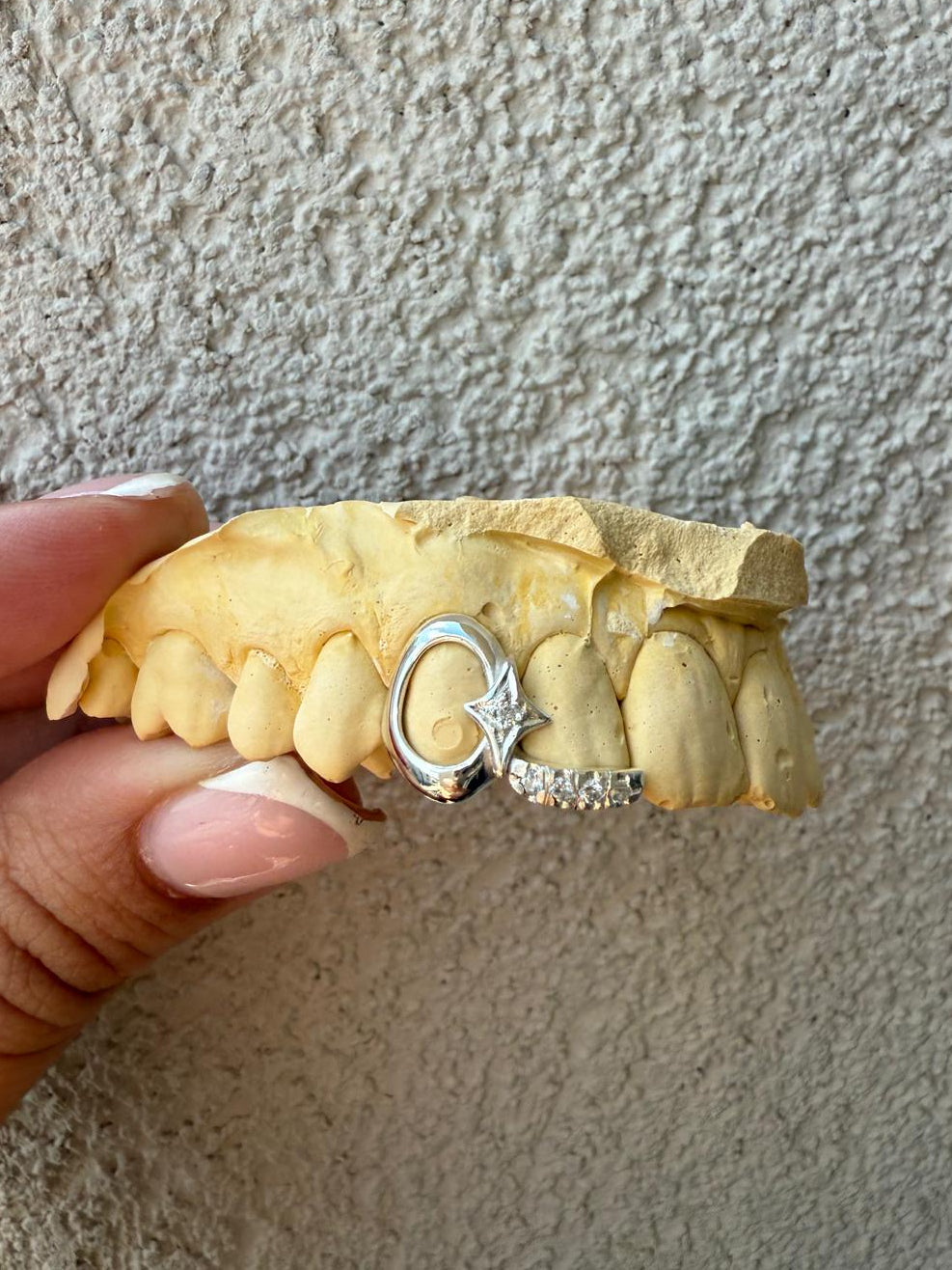 Star + Diamond Inlay - Grillz