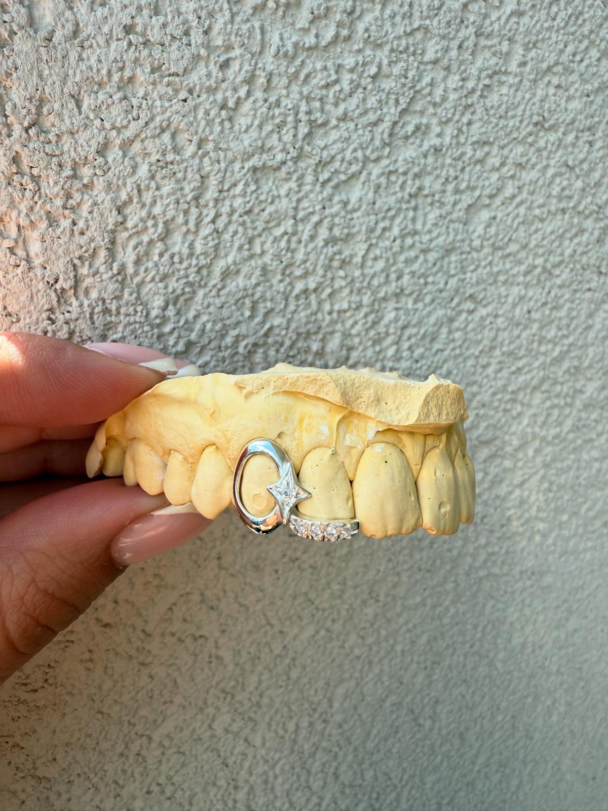 Star + Diamond Inlay - Grillz