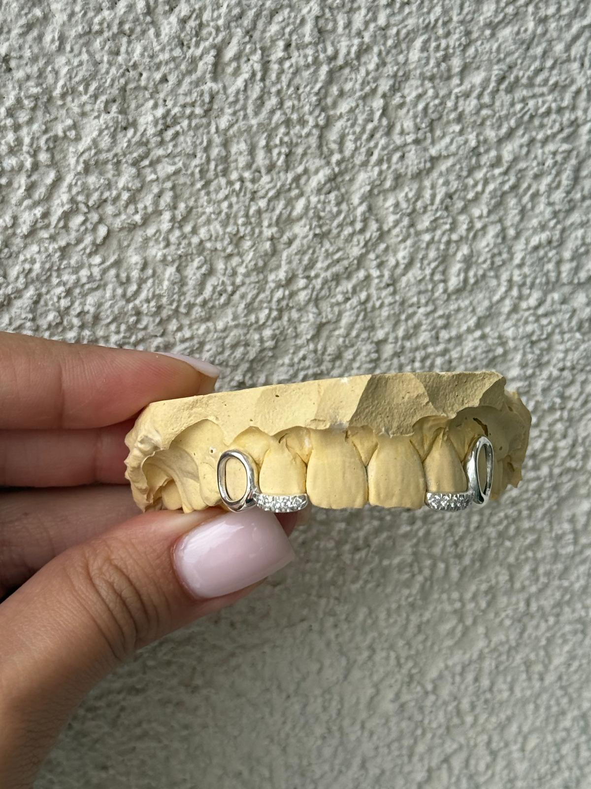 Double Window + Diamond Inlay - Grillz