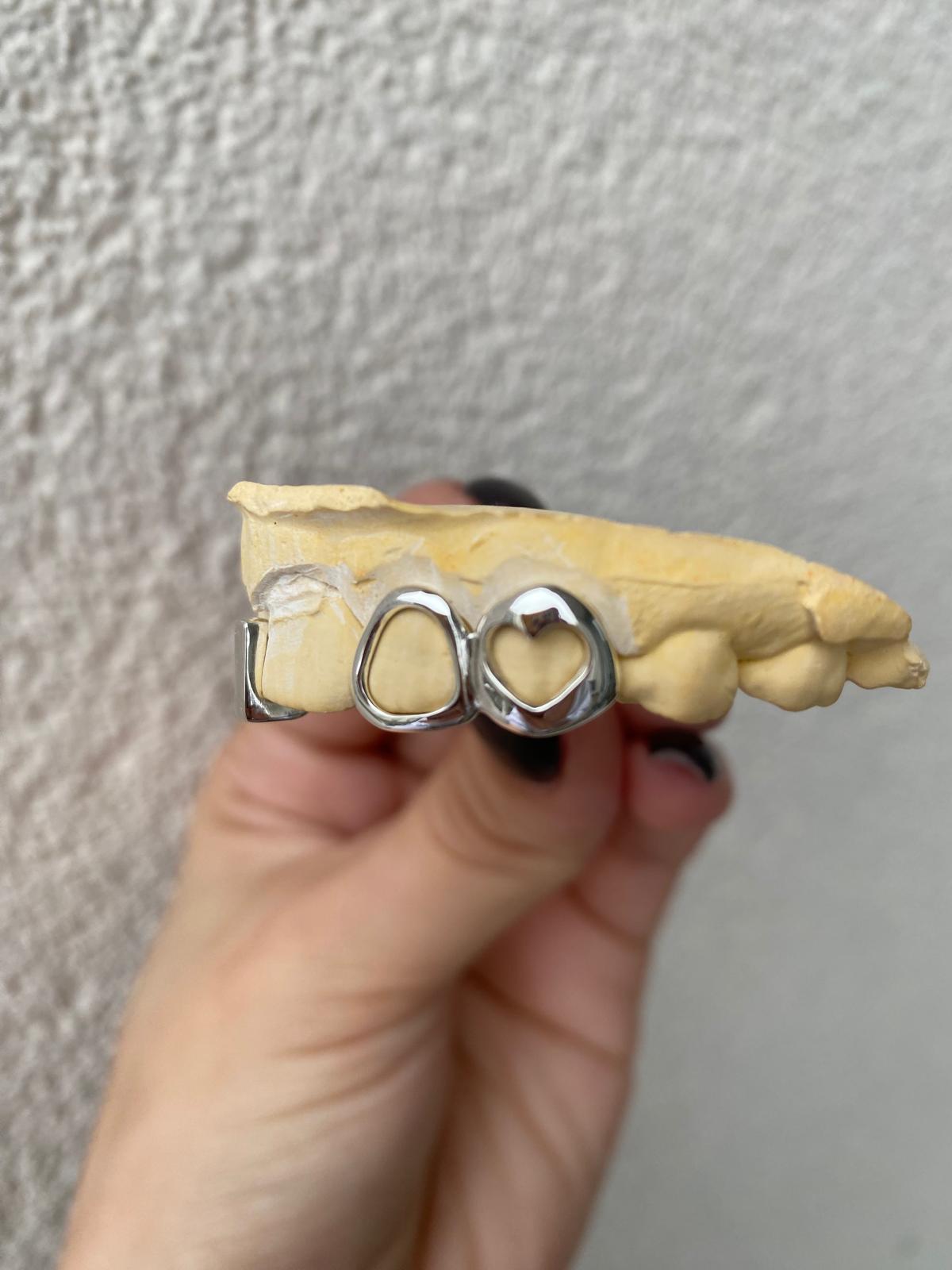 Gap Filler + Windows - Grillz