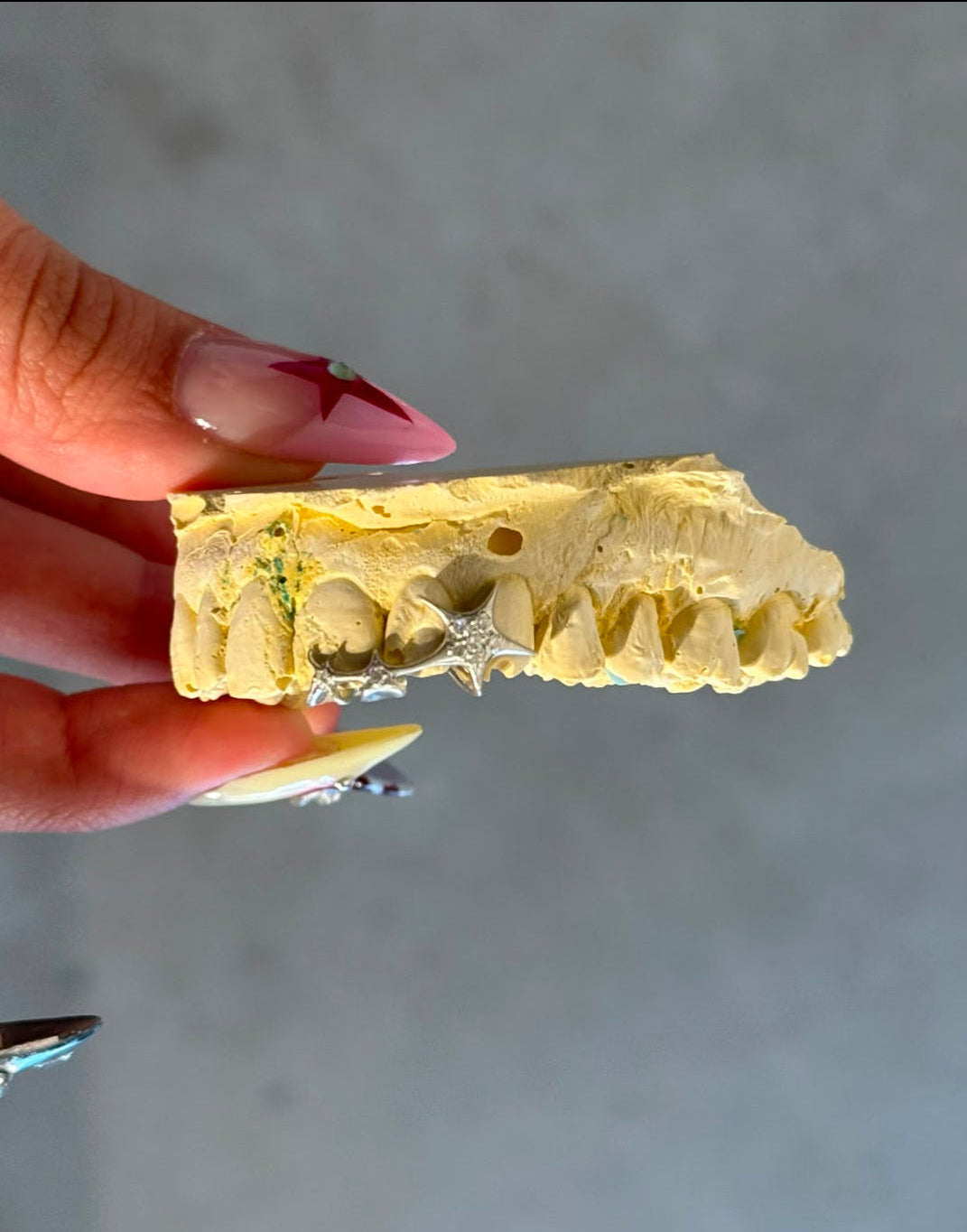 "Star Girl" Grillz
