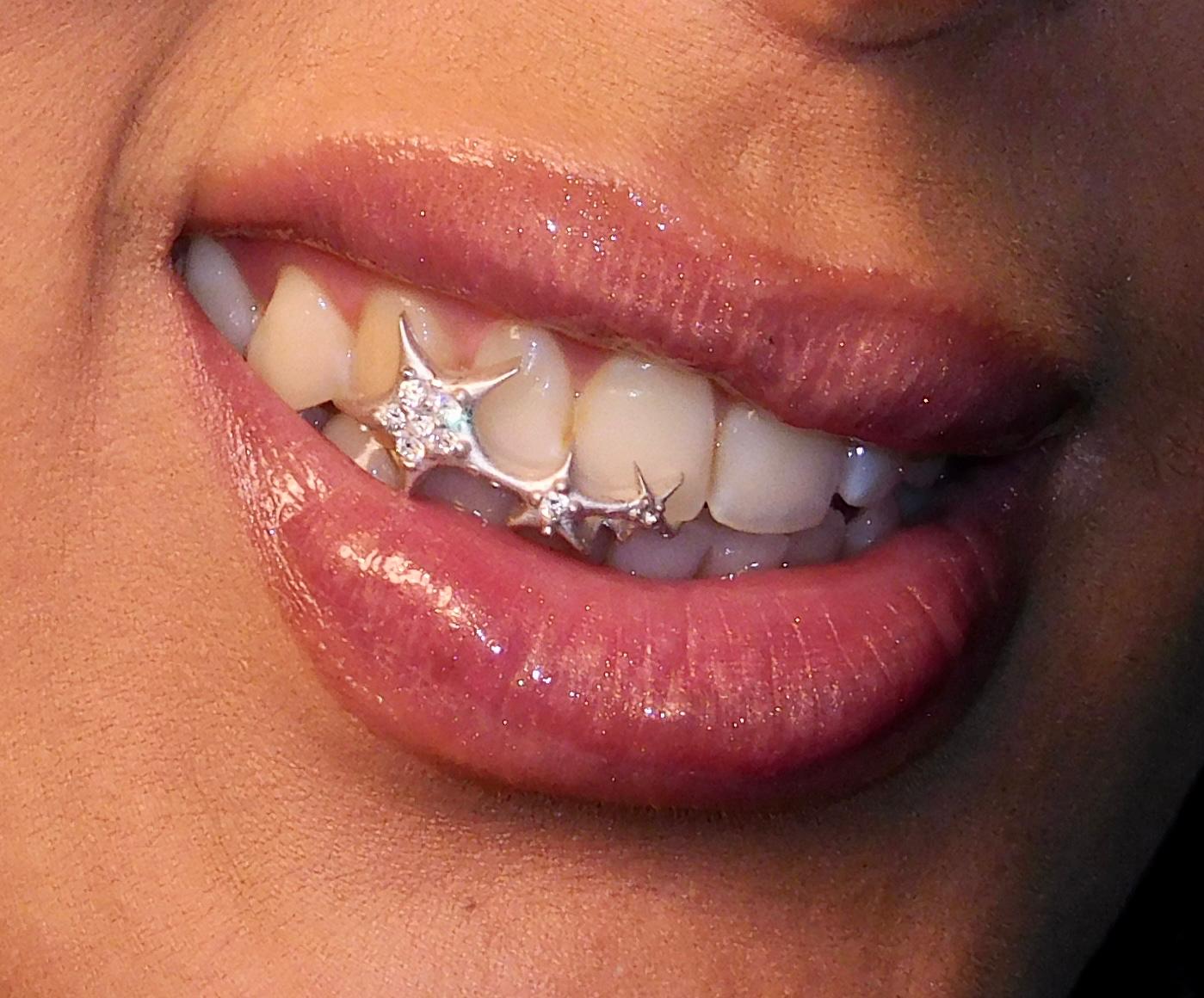 "Star Girl" Grillz