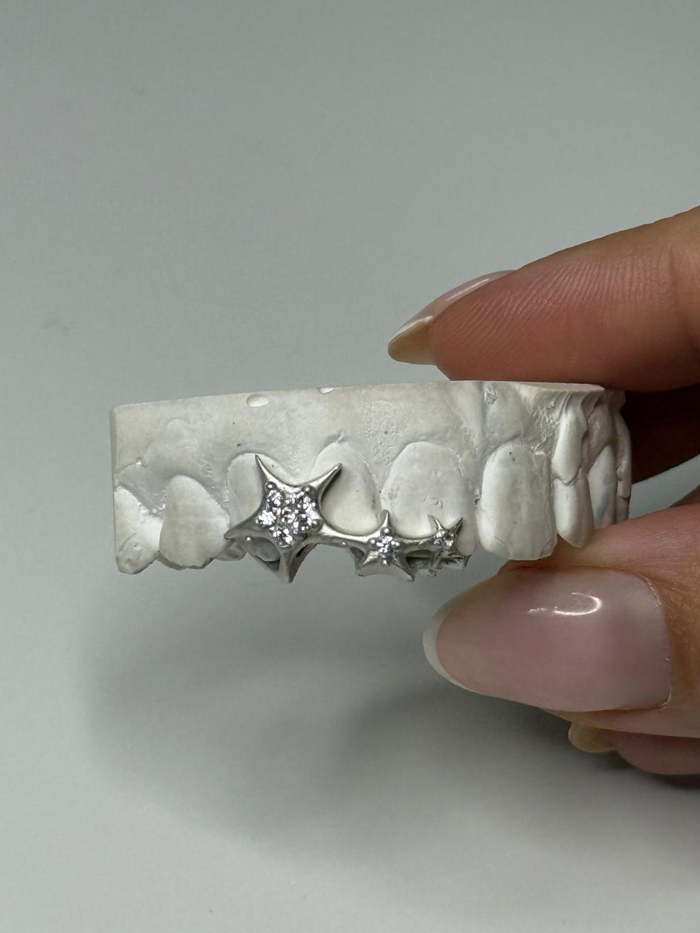 "Star Girl" Grillz