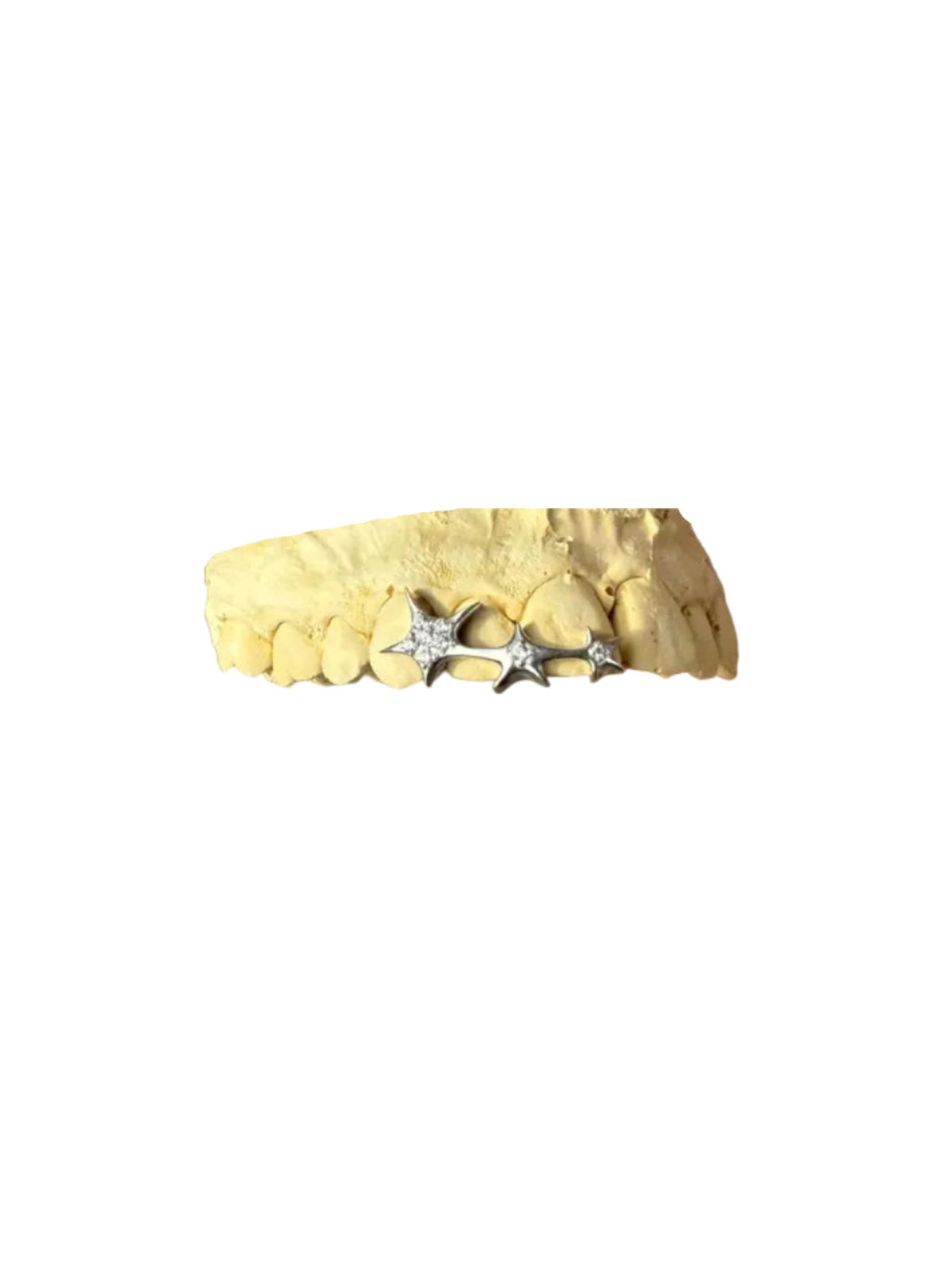 "Star Girl" Grillz