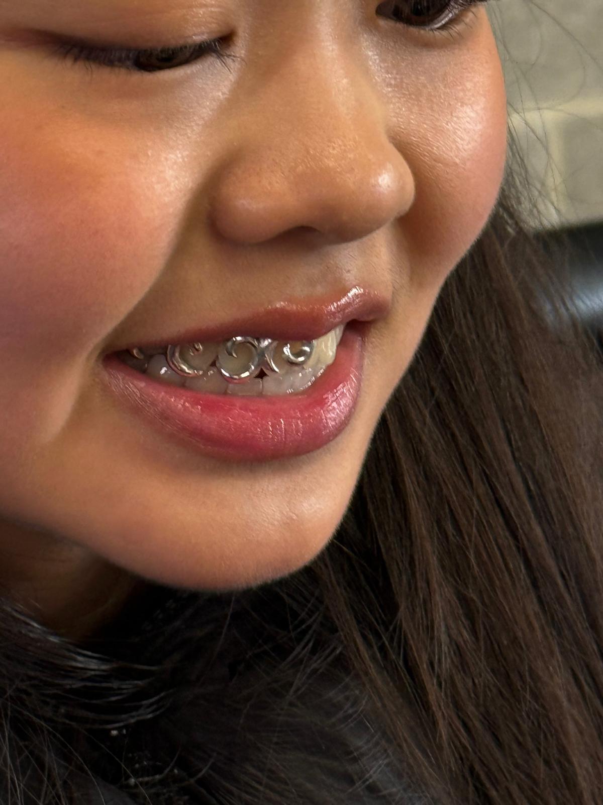 Wavy Design - Grillz